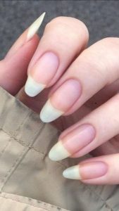 fortalece as unhas