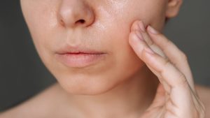 Dermatologistas Revelam os 5 Maiores Erros no cuidado com a Pele Oleosa